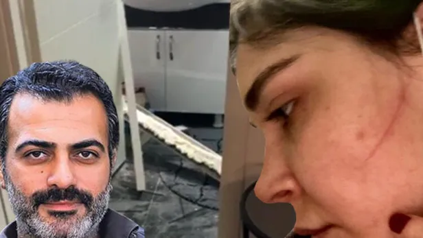 Sermiyan Midyat tarafından darbedilen Sevcan Yaşar o ses kaydını ortaya döktü! 'Çıplak görüntülerimi çekti' demişti...-8