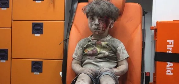 SURİYE'DEKİ İÇ SAVAŞTA YARALANAN 5 YAŞINDAKİ ''ÜMRAN DAKNES''