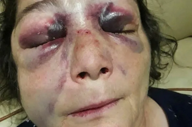 Sabah gazetesi yazarı Mevlüt Tezel'den Giresun Eynesil'deki CHP'li başkan skandalına sert tepki: CHP'liler dövünce kadına şiddet olmuyor mu?