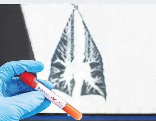 Prof. Dr. Oğuz Özyaral Kovid-19 şüphesiyle hastaneye kaldırıldı-2