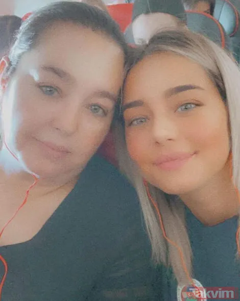 Burcu Özberk'in annesi sosyal medyayı salladı adeta sarı fırtına! Estetik haberleriyle gündemden düşmeyen Burcu Özberk... - 8