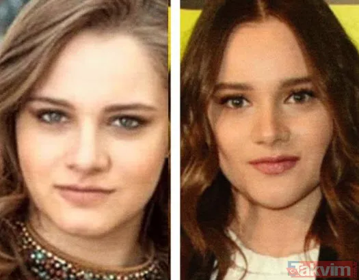 Aleyna Tilki hastanelik oldu paylaşımıyla korkuttu! Sette yürüyemez hale gelen Aleyna Tilki'ye ne oldu? - 26