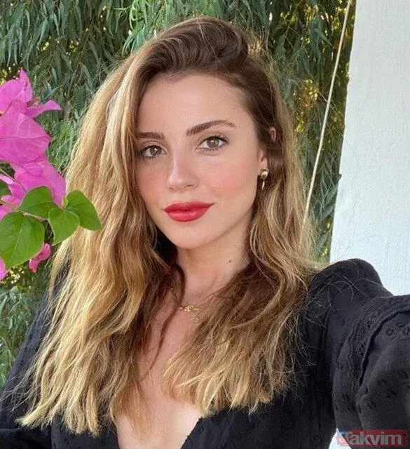 Ezgi Eyüboğlu 'estetik geçirmedim' dedi sosyal medya kanıtlarla geldi! Seda Sayan'ın gelini Ezgi estetikli mi estetiksiz mi? - 22