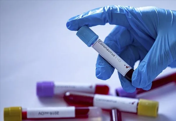 Singapurlu bilim insanlarından korkutan koronavirüs açıklaması! "Etkisi 20 yıl sürebilir"-4