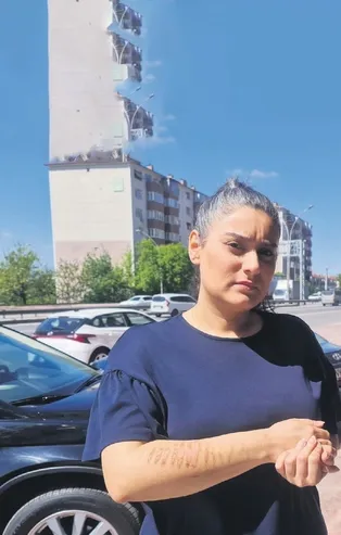 Güzellik merkezinde lazer epilasyon yaptıran Tuba Yıldız bin pişman oldu