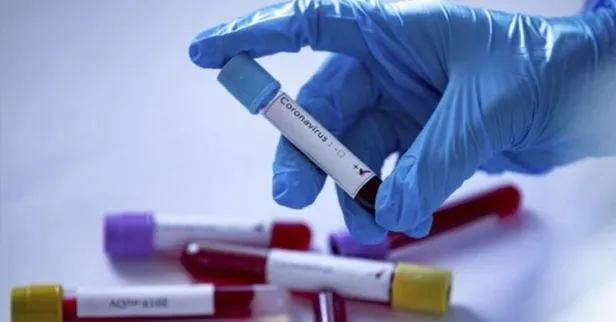 Son dakika: Koronavirüsün yeni belirtileri ortaya çıktı!-7