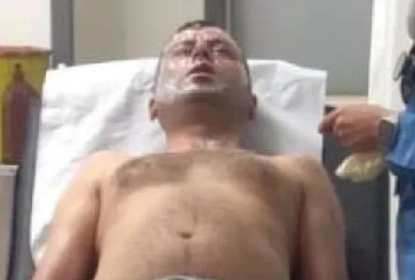 Lavabo açıcı bomba gibi patladı! Yüzünden yaralandı