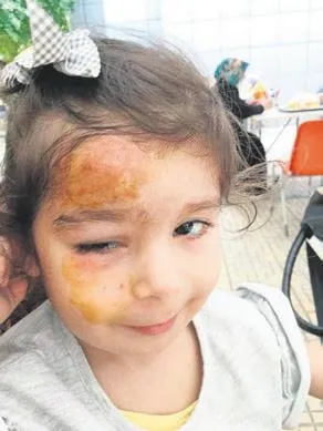 gozbebegi-premature-dogan-ikizlerden-arden-130-gun-gunluk-yasam-savasini-kazandi-1667431639940.jpeg Gözbebeği! Prematüre doğan ikizlerden Arden 130 gün günlük yaşam savaşını kazandı-3