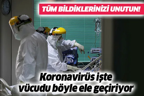 Son dakika: Koronavirüs işte böyle hasta ediyor-1