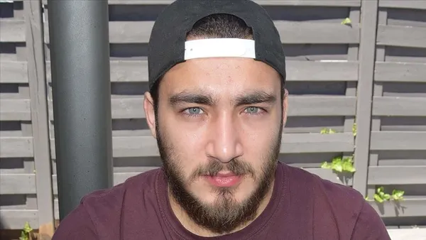 almanyada-turk-hastanin-yanlislikla-bobregi-alinmisti-doktor-goreve-devam-ediyor-1603992895968.jpg Almanya'da Türk hastanın yanlışlıkla böbreği alınmıştı... Doktor göreve devam ediyor!-3