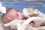 500 gram doğdu, hayata tutundu! Doruk bebeğin mucize hikayesi...