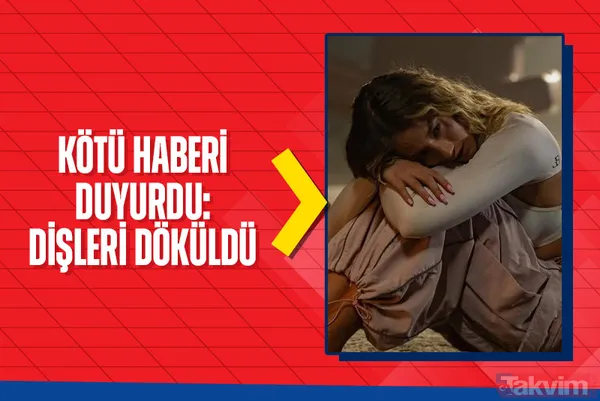 Survivor Aleyna Kalaycıoğlu kötü haberi duyurdu! “Dişleri döküldü” - 1