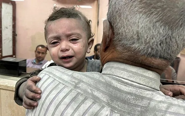 1699908766357.jpeg Terör devleti İsrail Gazze'de bir nefeslik oksijen bile bırakmadı! Filistinli Cevdet Medhun: "Şifa'da yaşamak ölmekten zor"-5