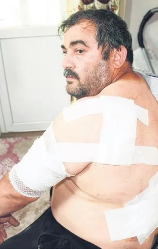 Bartın'da ineklerini otlatmaya çıkartan Ramazan Kadıncı ayı saldırasına maruz kaldı!