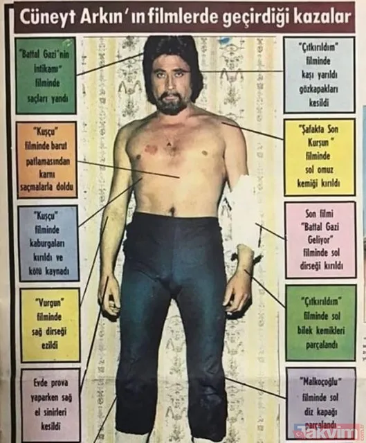 Kuruluş Osman'ın Aksaçlı'sı Cüneyt Arkın film kazalarında aldığı yaraları açıkladı! "Ekmeğimi kazanmak için..." - 2