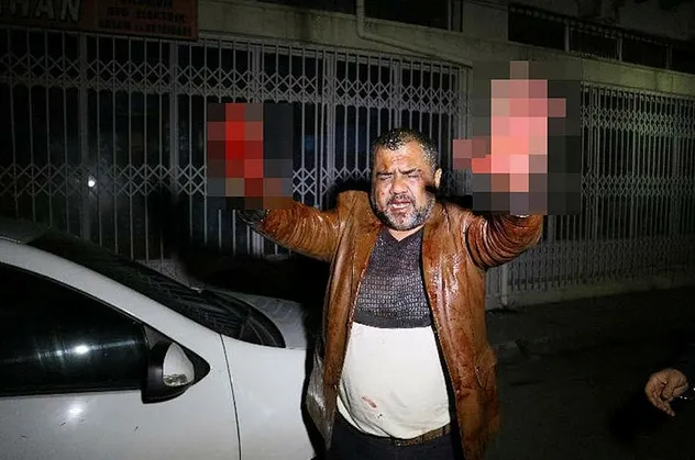 Adana'da korkunç olay! Sevgilisine dehşeti yaşattı