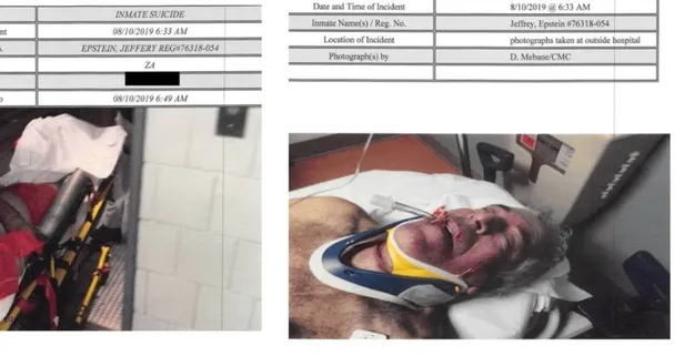 Epstein intihar mı etti öldürüldü mü? Otopsisini inceleyen doktordan açıklama