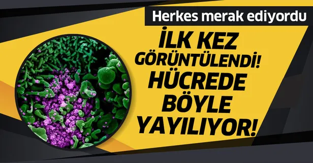 Koronavirüsün insan hücrelerindeki yayılışı mikroskopla görüntülendi