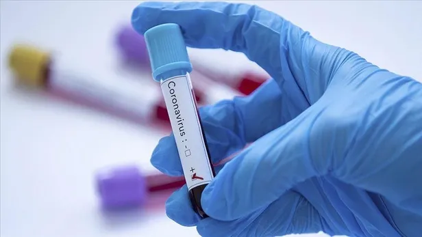 ozel-hastanelerde-koronavirus-testi-yaptiranlar-dikkat-odenen-ucretler-geri-alinabilir-1605458236226.jpeg Özel hastanelerde koronavirüs testi yaptıranlar dikkat! "Ödenen ücretler geri alınabilir"-4