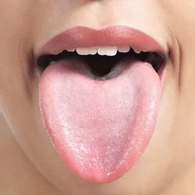 Diline bak hastalığını öğren!