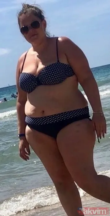 ✈ NHS REDDETTİ, ÇÖZÜM İÇİN TÜRKİYE'YE UÇTU İngiltere Ulusal Sağlık Servisi (NHS), Laura'nın beden kitle endeksi (BKİ) 40'ın altında olduğu için mide...