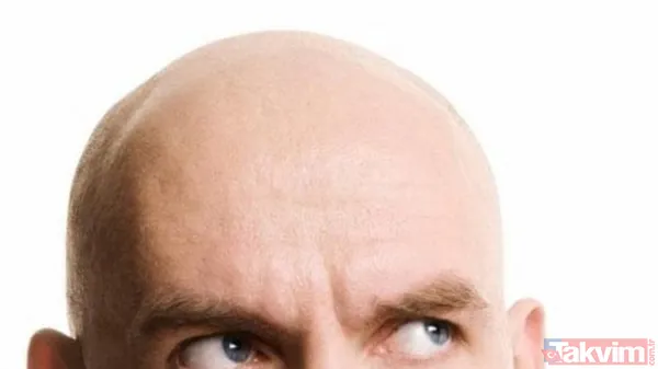 Kelliği tarihe gömüyor yapan göz alıcı sırma saçlara sahip oluyor! Saç ektirme işlemine servet dökmeden bu işi çözün - 1