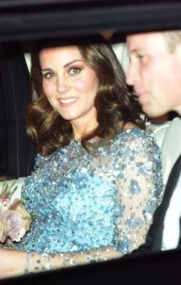 Kate Middleton'ın yüzüne ne oldu?