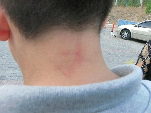 Antalya'da lise öğrencilerine şiddet iddiası! Aileler okul yönetiminden şikayetçi oldu-2