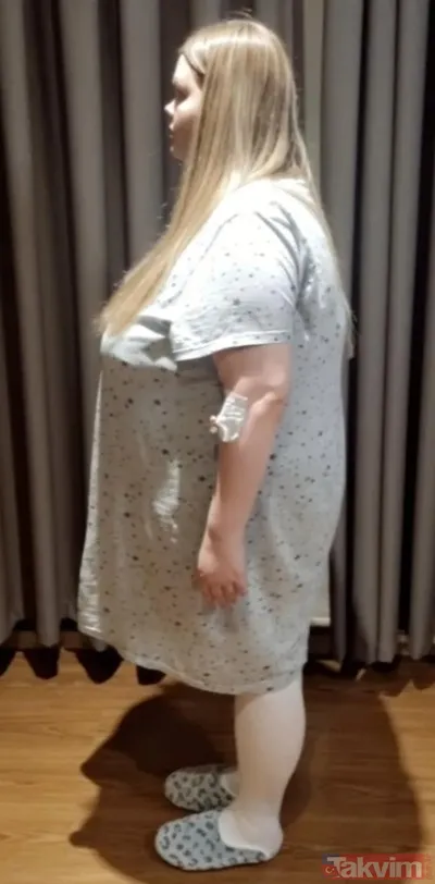 Günde 10 litre kola içen yemek bağımlısı anne Türkiye’de ameliyatla 83 kilo verdi - 7
