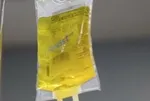 Sağlık Bakanlığı'ndan sarı serum açıklaması! Yüksek tansiyon ve kalp hastalığı olanlar dikkat!