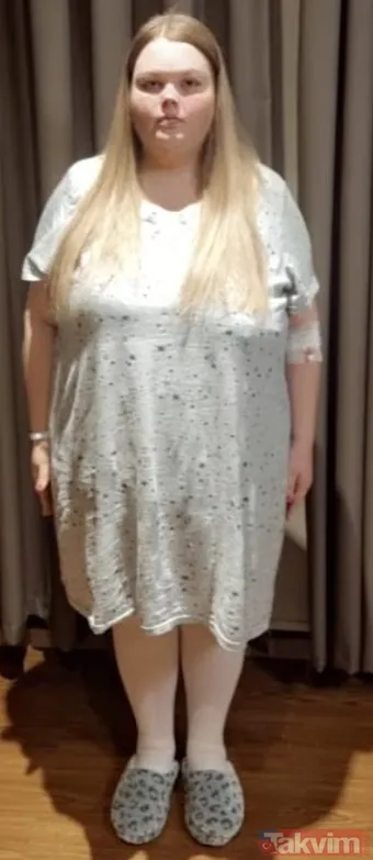 Günde 10 litre kola içen yemek bağımlısı anne Türkiye’de ameliyatla 83 kilo verdi - 5