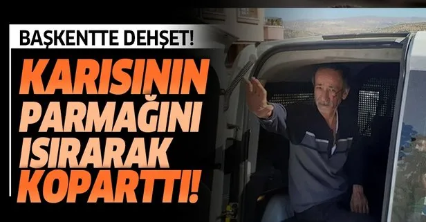 Ankara’da dehşet! Karısının parmağını ısırarak koparttı