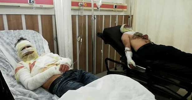 Sobayı benzinle tutuşturmaya çalıştılar! Kendileri yandı