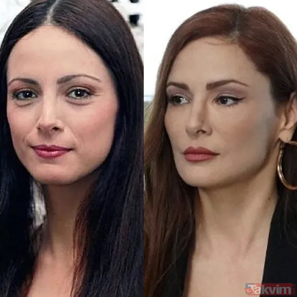 Yeşilçam’ın Sultan’ı Türkan Şoray'ın kızı Yağmur Ünal’ın son haline bakın! Botokstan konuşamadı! Gören şaştı kaldı - 9