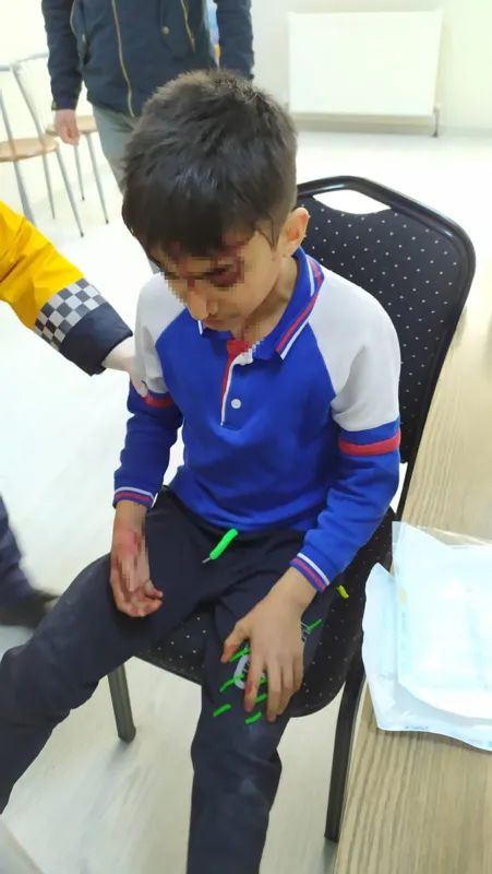 bu-sefer-kangal-ispartada-okuldan-eve-donen-13-yasindaki-ahmet-efe-erol-saldiriya-ugradi-basinda-3-isirik-var-1646129333237.jpg Bu sefer Kangal! Isparta'da okuldan eve dönen 13 yaşındaki Ahmet Efe Erol saldırıya uğradı: Başında 3 ısırık var-4