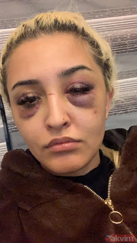 Eski sevgilisine dehşeti yaşattı: Ayrılmayı kabul etmedi 3 saat boyunca darp ederek tanınmaz hale getirdi! - 5