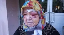 Edirne’de başıboş köpek dehşeti kamerada: Yaşlı kadının yüzü gözü tanınmaz halde