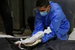 +18 İÇERİK! İsrail'in Gazze'deki soykırımından en acı görüntü! Doğmamış bebek annesiyle aynı cesed torbasında! İşte Netanyahu'nun çocuk katliamı