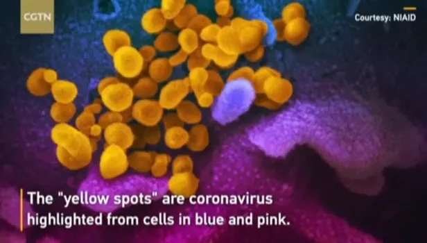 Koronavirüsün insan hücrelerindeki yayılışı mikroskopla görüntülendi
