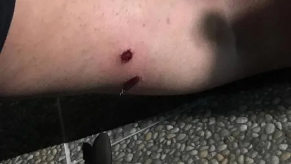 son-dakika-mescid-i-aksaya-saldiran-teror-devleti-israilin-polisleri-turk-gazeteciyi-plastik-mermiyle-vurdu-1620680883115.jpeg Son dakika: Mescid-i Aksa'ya saldıran terör devleti İsrail'in polisleri Türk gazeteciyi plastik mermiyle vurdu-2