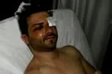 Dizide rol değil parkta dayak