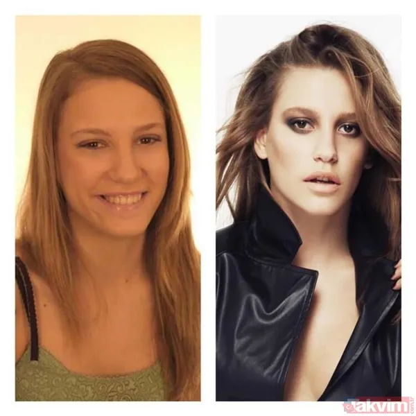 47 kiloya düşen Tanyeli'nin son hali şoke etti! Pankreas kanseriyle mücadele ediyor! "10 gün sonra evden ilk defa çıkabildim..." - 43