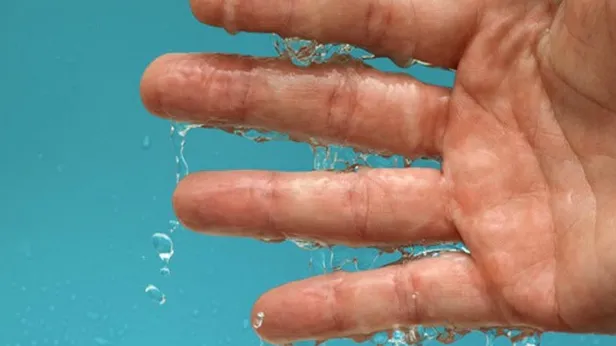 Avuç içi terleyenleri bu dertten kurtaracak yöntem! Meğer kurtulmak bu kadar basit