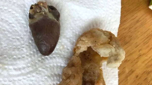 Fast-food zincirinden aldığı tavuktan çiğ kalp çıktı-2