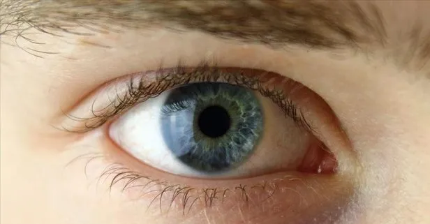 Göz tansiyonu sinirlere zarar veriyor! Sinsi ilerleyip körlüğe neden olabiliyor