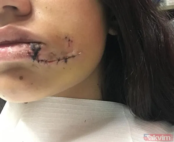 Sadece fotoğraf çektirmek istedi genç kız hayatının şokunu yaşadı! Bir anda üzerine atladı ne var yok... - 25