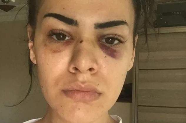 İstanbul'da taciz dehşeti! Genç kadın yaşadığı korku dolu anları anlattı: Kan kusmaya başladım