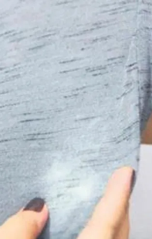 Lekelere elveda | Pratik bilgiler