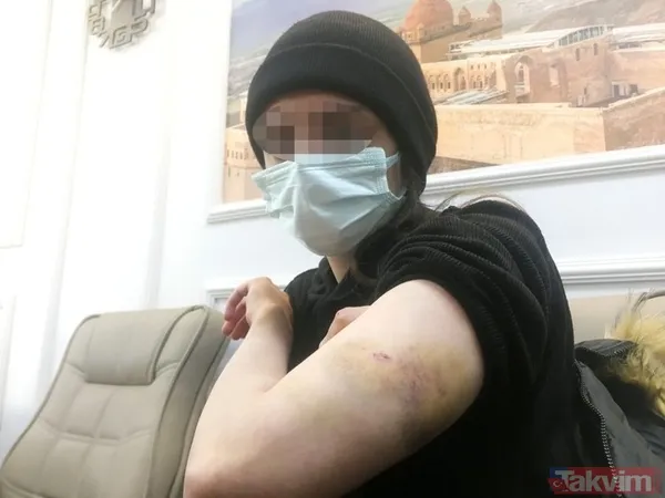 Kadınlardan kadınlara korkunç taciz ve işkence! Mağdur sayısı artıyor! "Yüzümde sigara söndürdüler" - 13