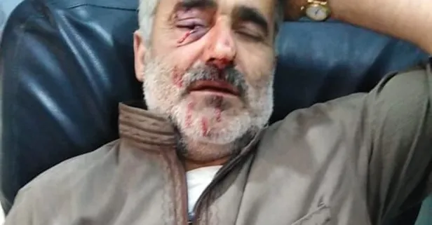 Son dakika: Afrin'e saldırı: 2 ölü, 1 yaralı